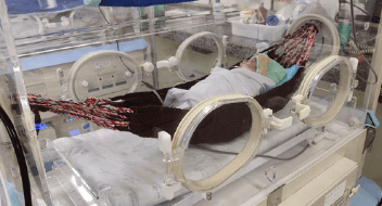 mini hamac pour bébé au Brésil à l'Hôpital Général Dr César Cals – HGCC